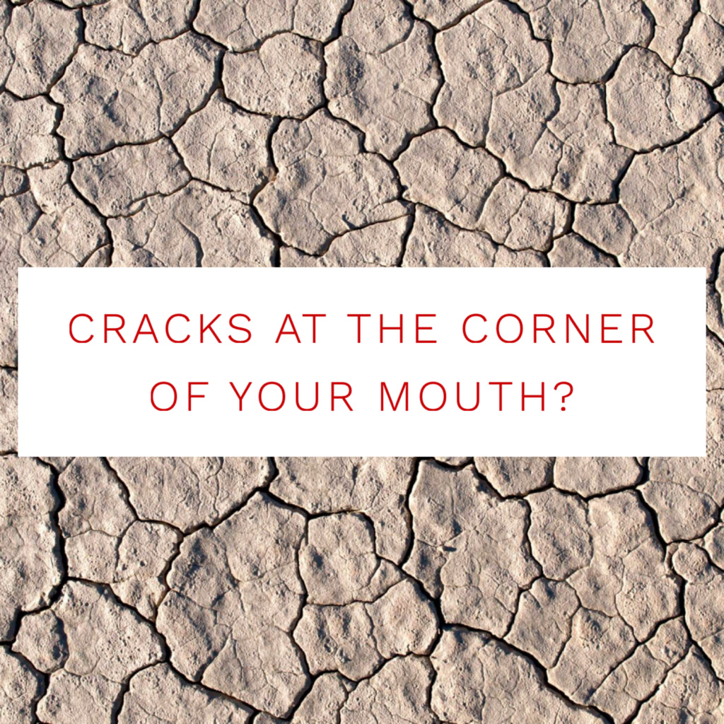 Cracks at the Corner of the Mouth